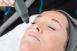 lady having a facial using local cryotherapy