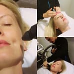 Cryotherapy Facial! the Best way to Brighter Tighter Skin!