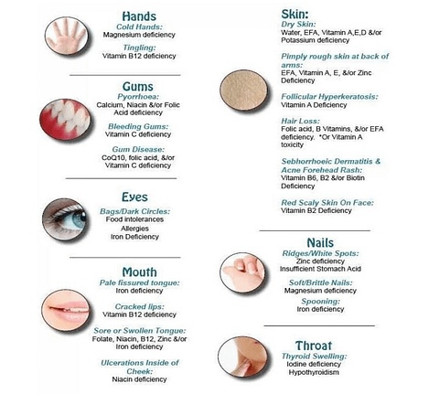 Symptoms of vitamin and mineral deficiency | Cryojuvenate UK