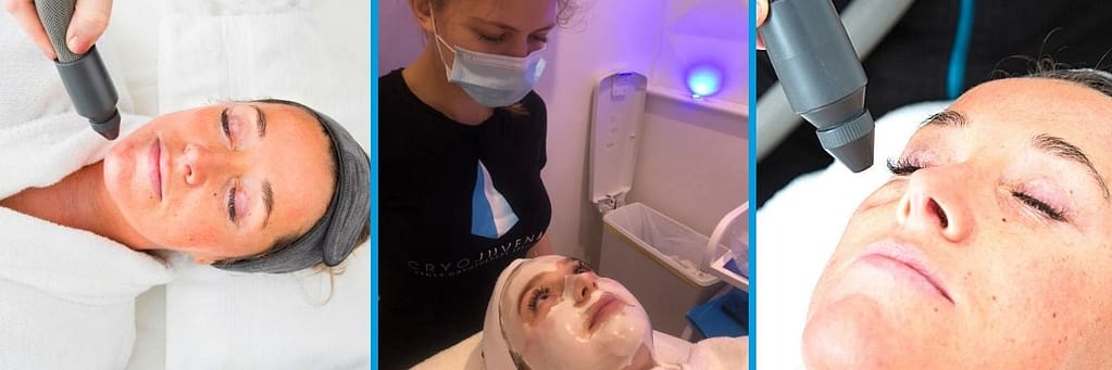 Pretty girl having an ICY cyrotherapy facial with algae face mask at Cryojuvenate