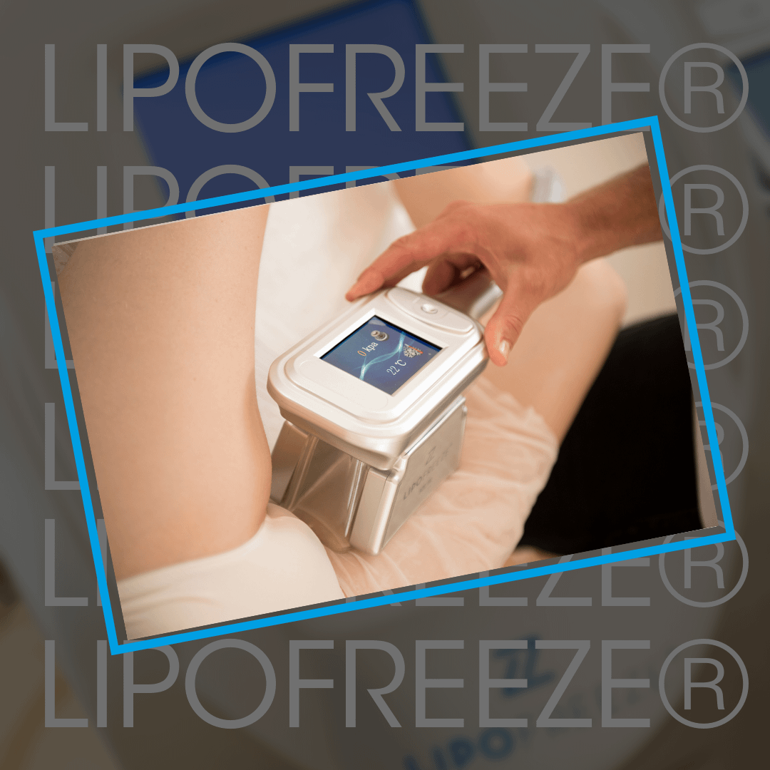 Cryolipolysis Fat Freezing for the inner thighs at Cryojuvenate in Sevenoaks