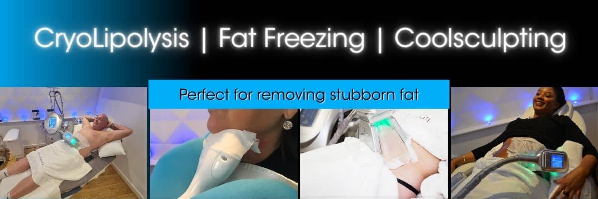 cryolipolysis fat freezing treatments at cryojuvenate sevenoaks kent
