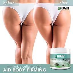 5kind-slimming-cream-available-at-cryojuvenate-kent